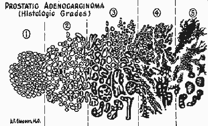 gleason's drawing 