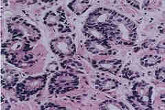 photo of pathology slide