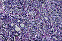 photo of pathology slide