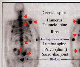 portion of image