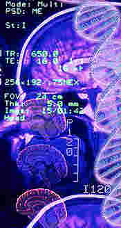 montage of cat scan images