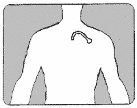 line drawing showing location of port