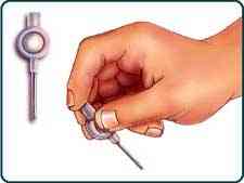 drawing showing the MUSE applicator