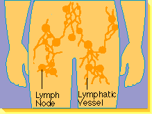 diagram showing lymph glands nodes in the pelvic area