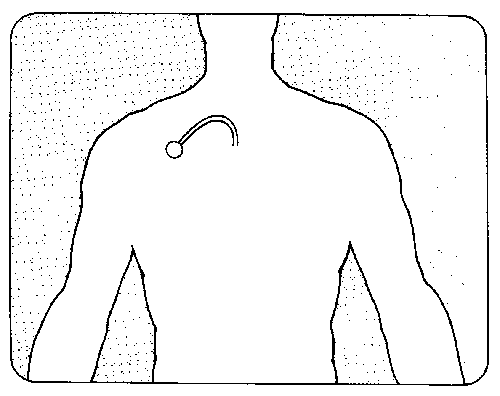 location of a port