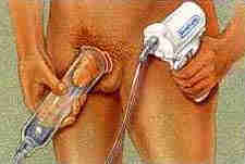showing placement of the VED