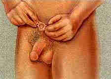 when the ring is removed, the penis will become flaccid