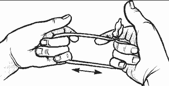 illustration of the procedure